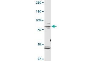 TRPV1 monoclonal antibody (M01), clone 1F5.