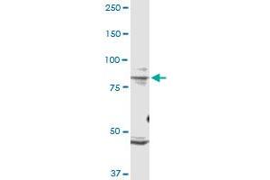 TRPV1 monoclonal antibody (M01), clone 1F5. (TRPV1 anticorps  (AA 21-124))