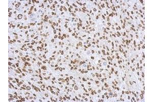 IHC-P Image Immunohistochemical analysis of paraffin-embedded C2C12 xenograft, using Lamin A + C, antibody at 1:500 dilution. (Lamin A/C anticorps)