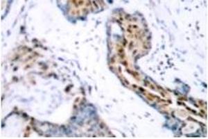 Image no. 2 for anti-Estrogen Receptor 1 (ESR1) (pSer118) antibody (ABIN318018) (Estrogen Receptor alpha anticorps  (pSer118))