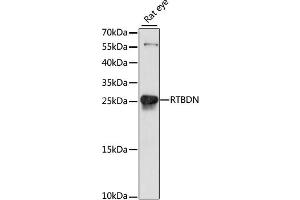 Western blot analysis of extracts of rat eye, using RTBDN antibody (ABIN6293760) at 1:1000 dilution. (Retbindin anticorps)