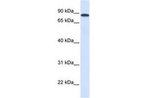 Image no. 1 for anti-DEAD (Asp-Glu-Ala-Asp) Box Polypeptide 1 (DDX1) (AA 432-481) antibody (ABIN6742674) (DDX1 anticorps  (AA 432-481))