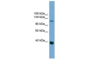 Catenin antibody used at 1 ug/ml to detect target protein. (Catenin anticorps)