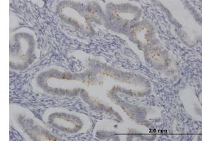 Immunoperoxidase of monoclonal antibody to SPP1 on formalin-fixed paraffin-embedded human endometrium. (Osteopontin anticorps  (AA 148-257))