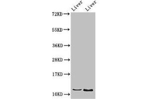 Western Blot Positive WB detected in: Rat liver tissue, Mouse liver tissue All lanes: DDA1 antibody at 2. (DDA1 anticorps  (AA 1-102))