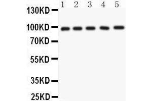 Anti- NUP98 Picoband antibody, Western blotting All lanes: Anti NUP98  at 0. (NUP98 anticorps  (AA 549-880))