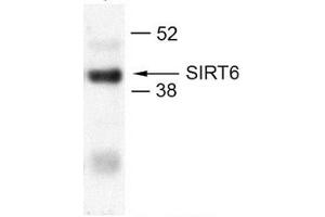 U2OS (SIRT6 anticorps  (N-Term))
