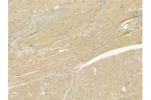 ABIN6265892 and ABIN6276955 at 1/100 staining human tongue carcinoma by IHC-P. (Uromodulin anticorps  (C-Term))