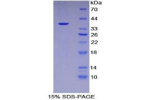 SDS-PAGE (SDS) image for Keratin 15 (KRT15) (AA 105-411) protein (His tag) (ABIN1170814)