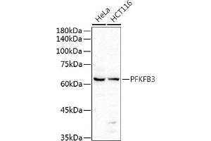 Western blot analysis of extracts of various cell lines, using PFKFB3 antibody (ABIN6129841, ABIN6145485, ABIN6145487 and ABIN6222692) at 1:500 dilution. (PFKFB3 anticorps  (AA 400-500))