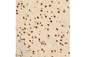 Immunohistochemistry of paraffin embedded rat brain using smad62024 (ABIN7075629) at dilution of 1:1500 (400x lens)