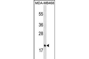 PGLYRP1 Antibody (C-term) (ABIN1536730 and ABIN2850071) western blot analysis in MDA-M cell line lysates (35 μg/lane). (PGLYRP1 anticorps  (C-Term))