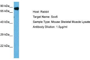 Host: Mouse Target Name: SOX6 Sample Tissue: Mouse Skeletal Muscle Antibody Dilution: 1ug/ml (SOX6 anticorps  (Middle Region))