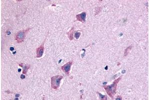 Anti-QRFPR / GPR103 antibody  ABIN1049284 IHC staining of human brain, neurons and glia. (QRFPR anticorps  (N-Term))
