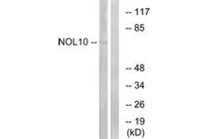 Western blot analysis of extracts from HuvEc cells, using NOL10 Antibody. (NOL10 anticorps  (AA 639-688))