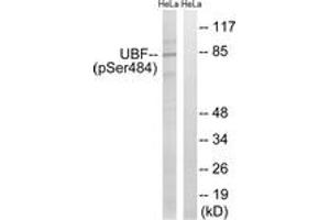 Western blot analysis of extracts from HeLa cells treated with calyculinA 50ng/ml 30', using UBF (Phospho-Ser484) Antibody. (UBTF anticorps  (pSer484))