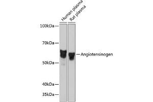 Western blot analysis of extracts of various cell lines, using Angiotensinogen Rabbit mAb (ABIN7265598) at 1:1000 dilution.