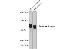 Western blot analysis of extracts of various cell lines, using Angiotensinogen Rabbit mAb (ABIN7265598) at 1:1000 dilution. (AGT anticorps)