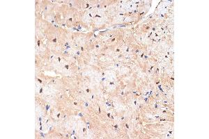 Immunohistochemistry of paraffin-embedded mouse heart using sestrin 1 Rabbit mAb (ABIN7270259) at dilution of 1:100 (40x lens). (SESN1 anticorps)