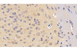 Detection of DLG4 in Mouse Cerebrum Tissue using Polyclonal Antibody to Discs, Large Homolog 4 (DLG4) (DLG4 anticorps  (AA 1-393))
