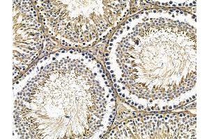 ABIN7096713 and ABIN7100778 at 1/100 staining rat testis tissue by IHC-P.