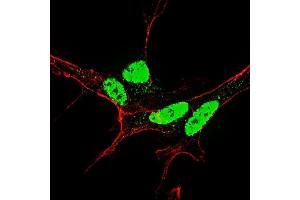 Fluorescent confocal image of SY5Y cells stained with (ABIN390032 and ABIN2839782) Phospho-Nanog-S71 antibody. (Nanog anticorps  (pSer71))