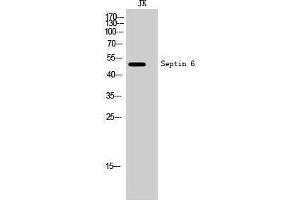 Western Blotting (WB) image for anti-Septin 6 (SEPT6) (Internal Region) antibody (ABIN3177370) (Septin 6 anticorps  (Internal Region))