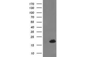 Western Blotting (WB) image for anti-Destrin (Actin Depolymerizing Factor) (DSTN) antibody (ABIN1497910) (Destrin anticorps)