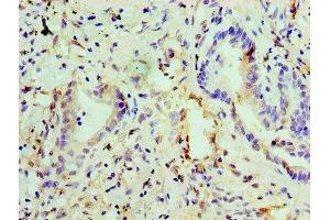 Immunohistochemistry of paraffin-embedded human lung tissue using ABIN7151444 at dilution of 1:100