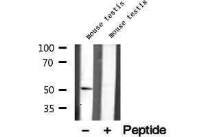 Western blot analysis of extracts of mouse testis tissue, using IFT52 antibody. (IFT52 anticorps  (Internal Region))