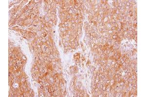 IHC-P Image Immunohistochemical analysis of paraffin-embedded BT474 xenograft, using GMF beta, antibody at 1:500 dilution.
