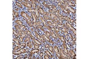 IHC analysis of CBR1 using anti-CBR1 antibody (ABIN7600015). (CBR1 anticorps  (AA 14-262))