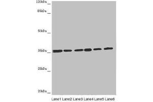 Western blot All lanes: ETFA antibody at 4. (ETFA anticorps  (AA 1-333))