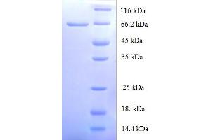SDS-PAGE (SDS) image for Origin Recognition Complex, Subunit 4 (ORC4) (AA 1-436), (full length) protein (His-SUMO Tag) (ABIN5710049)