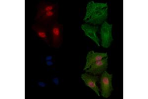 ABIN7094385 and ABIN7098432 staining  cells by IF/ICC. (NDOR1 anticorps  (N-Term))