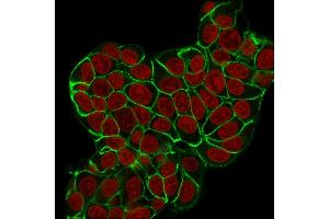 Immunofluorescence Analysis of MCF-7 cells labeling CHD1 with E-Cad Rabbit Recombinant Monoclonal Antibody (CDH1/2208R) followed by Goat anti-Mouse IgG-CF488 (Green).