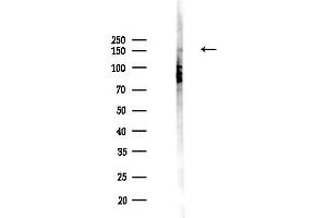 Western blot analysis of lysates from PC12 cells(UV,30 min treatment), using Phospho-EGFR (Thr669)[Tyr693] Antibody at 1/1000 dilution.
