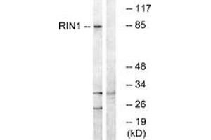 Western blot analysis of extracts from K562 cells, using RIN1 Antibody. (RIN1 anticorps  (AA 655-704))