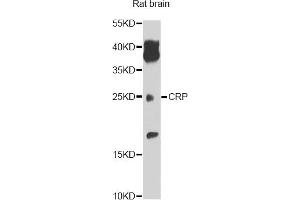 Western blot analysis of extracts of rat brain, using CRP antibody (ABIN5970054) at 1/1000 dilution. (CRP anticorps)
