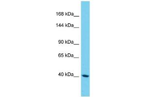 Western Blotting (WB) image for anti-Sterile alpha Motif Domain Containing 9-Like (SAMD9L) (N-Term) antibody (ABIN2790581) (SAMD9L anticorps  (N-Term))