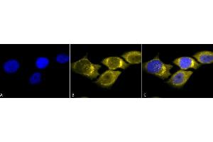 Immunocytochemistry/Immunofluorescence analysis using Rabbit Anti-SOD (Mn) Polyclonal Antibody (ABIN361655 and ABIN361656). (SOD2 anticorps)