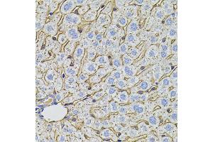 Immunohistochemistry of paraffin-embedded mouse liver using PCSK9 antibody. (PCSK9 anticorps)