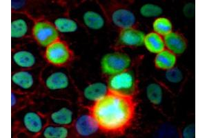 Immunofluorescence staining (human cervix carcinoma cells) Immunofluorescence staining of HeLa human cervix carcinoma cell line using purified anti-Ku Antigen (MEM-54) (detection by Goat anti-mouse IgG2a Alexa Fluor ® 488; green). (X-Ray Repair Cross Complementing 5 anticorps)