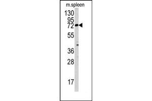 Image no. 1 for anti-Mannosyl (Beta-1,4-)-Glycoprotein beta-1,4-N-Acetylglucosaminyltransferase (MGAT3) (N-Term) antibody (ABIN357703) (MGAT3 anticorps  (N-Term))