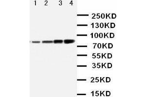 Anti-PI 3 Kinase p85 alpha antibody, Western blotting Lane 1: MCF-7 Cell Lysate Lane 2: HELA Cell Lysate Lane 3: COLO Cell Lysate Lane 4: SW620 Cell Lysate (PIK3R1 anticorps  (N-Term))