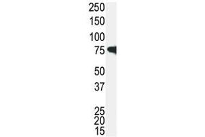 Western blot analysis of IRAK antibody and Jurkat cell lysate.