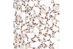 Immunohistochemistry of paraffin embedded mouse lung using NSFL1C (ABIN7074865) at dilution of 1:700 (400x lens)