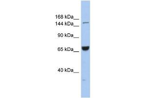 WB Suggested Anti-KIF15 Antibody Titration:  0. (KIF15 anticorps  (Middle Region))