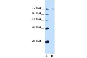 GALNT6 antibody used at 5 ug/ml to detect target protein. (GALNT6 anticorps  (N-Term))