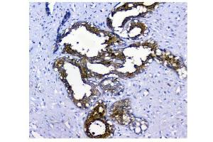 IHC analysis of NMI using anti-NMI antibody (ABIN3043451). (NMI anticorps  (AA 2-307))